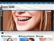 Tablet Screenshot of bracesguide.com